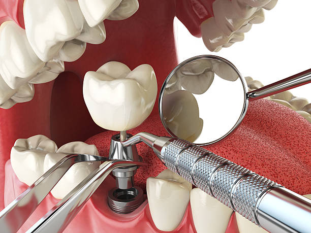Best Emergency Cosmetic Dentistry in Bellbrook, OH
